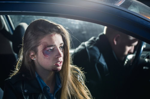 What to Do If You're Injured in a Car Accident as a Passenger 2 Passenger injury in car accident