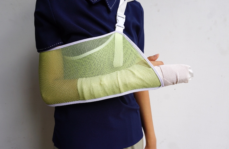 woman is wearing a soft cast and arm sling